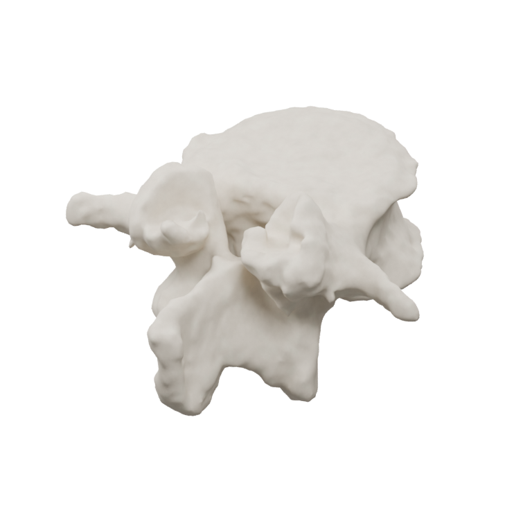 Anatomical 3D model