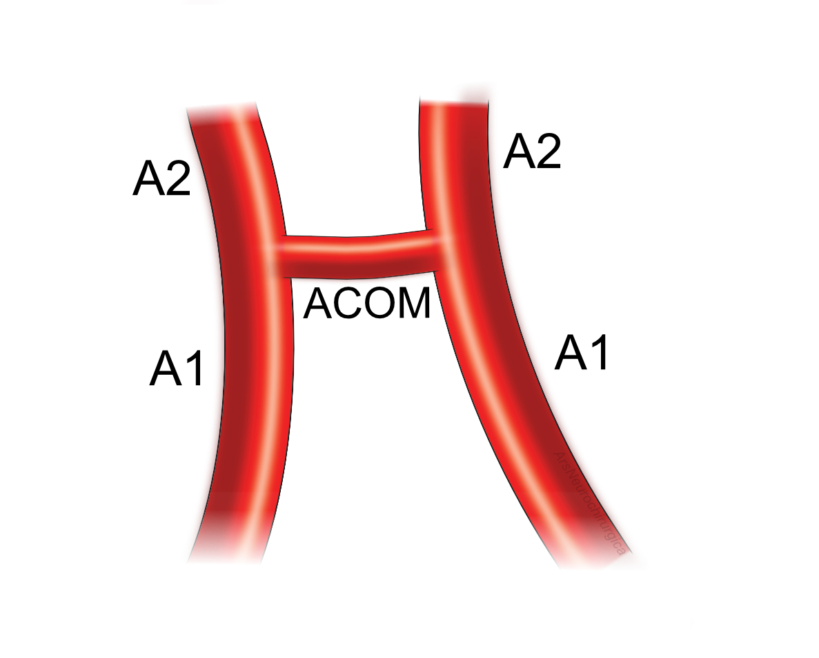Arteria communicans anterior schematisch