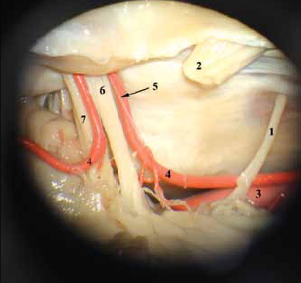 Arteria labyrinthi