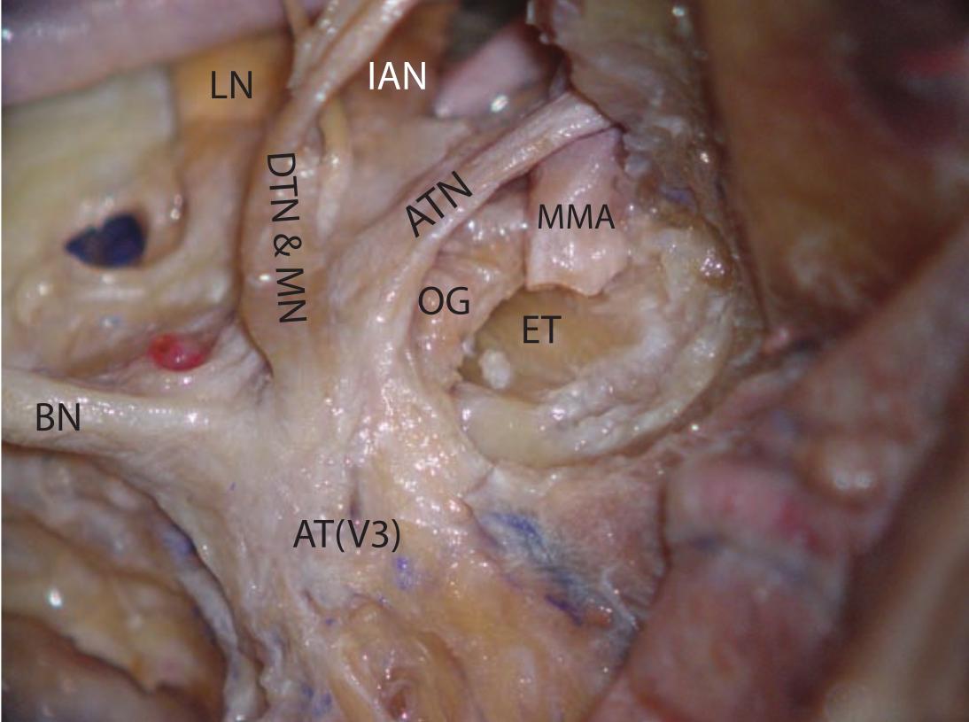 Ganglion oticum