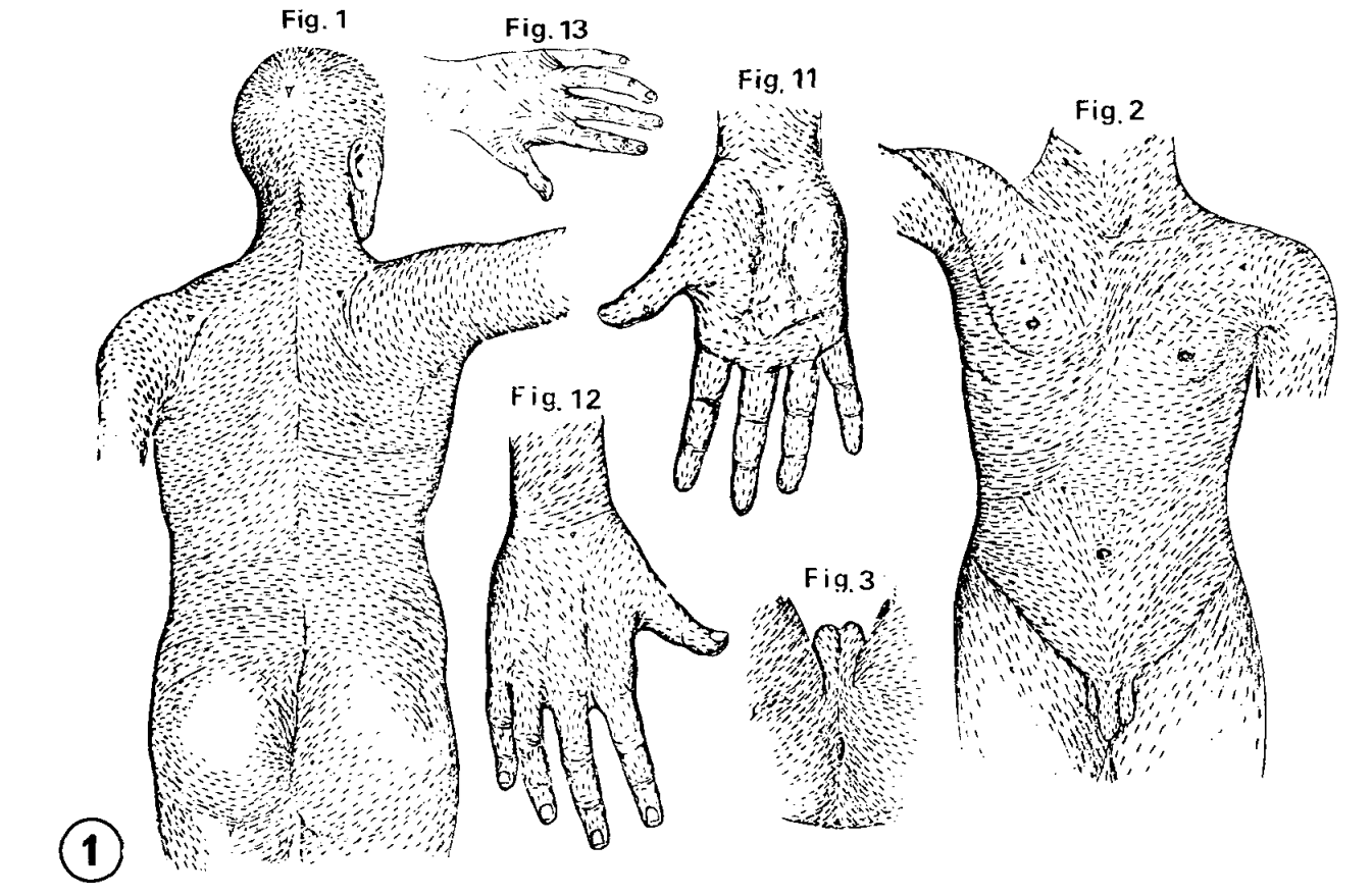 Langer Linien Figure 1