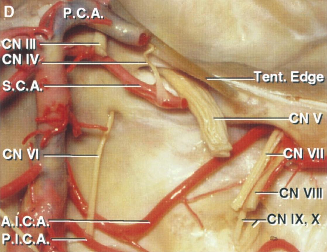 AICA und SCA im Bezug auf den Meatus acusticus internus
