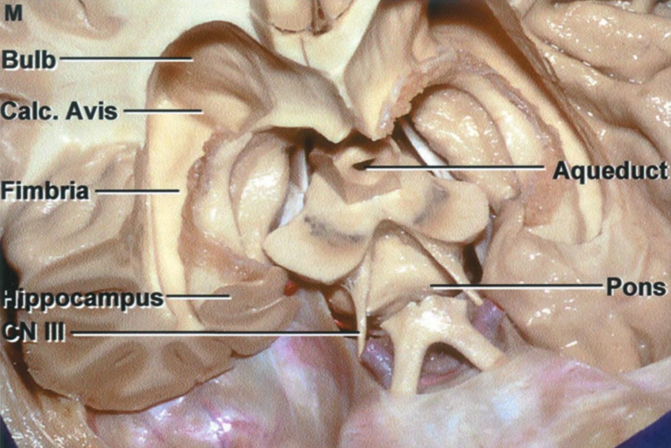 Anatomieabbildung Rhoton