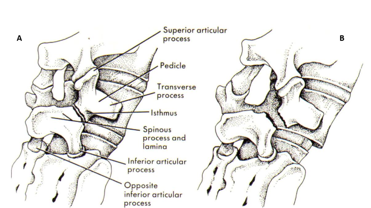 Scottie Dogn Sign Schematisch