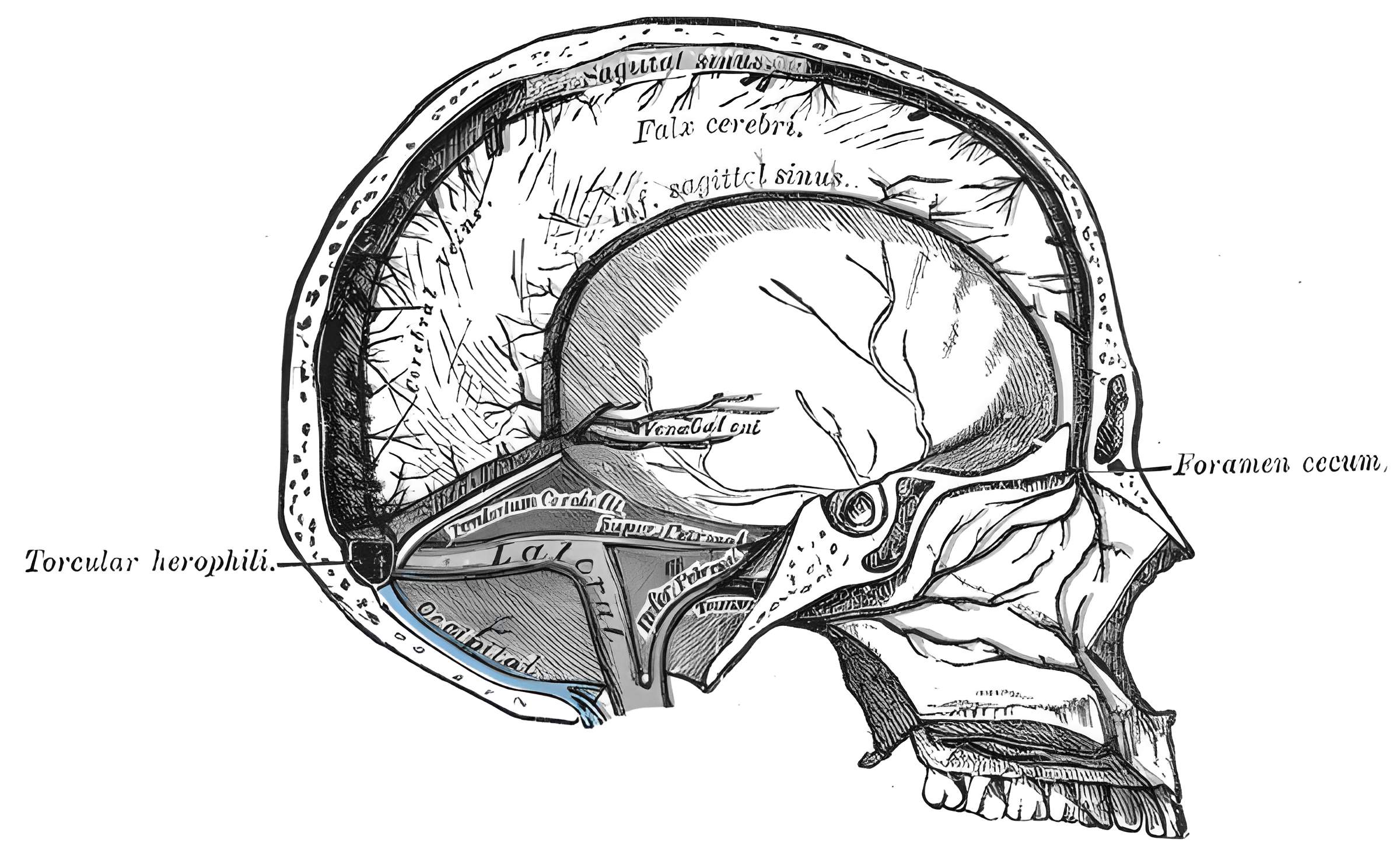 Sinus occipitalis anatomische Zeichnung