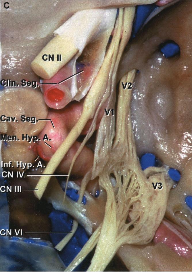 Cranial base Rhoton