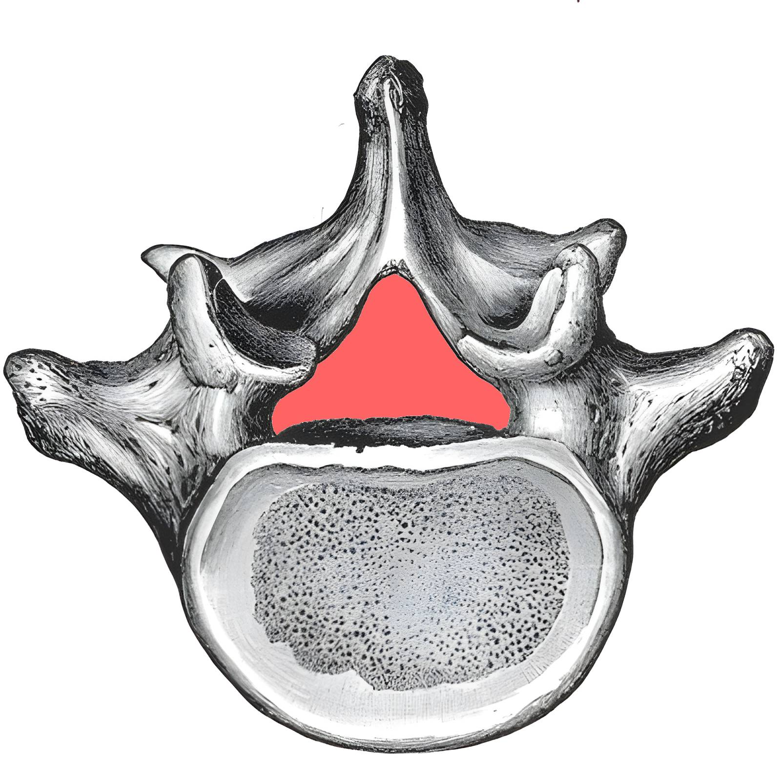 Spinalkanal schematische Darstellung
