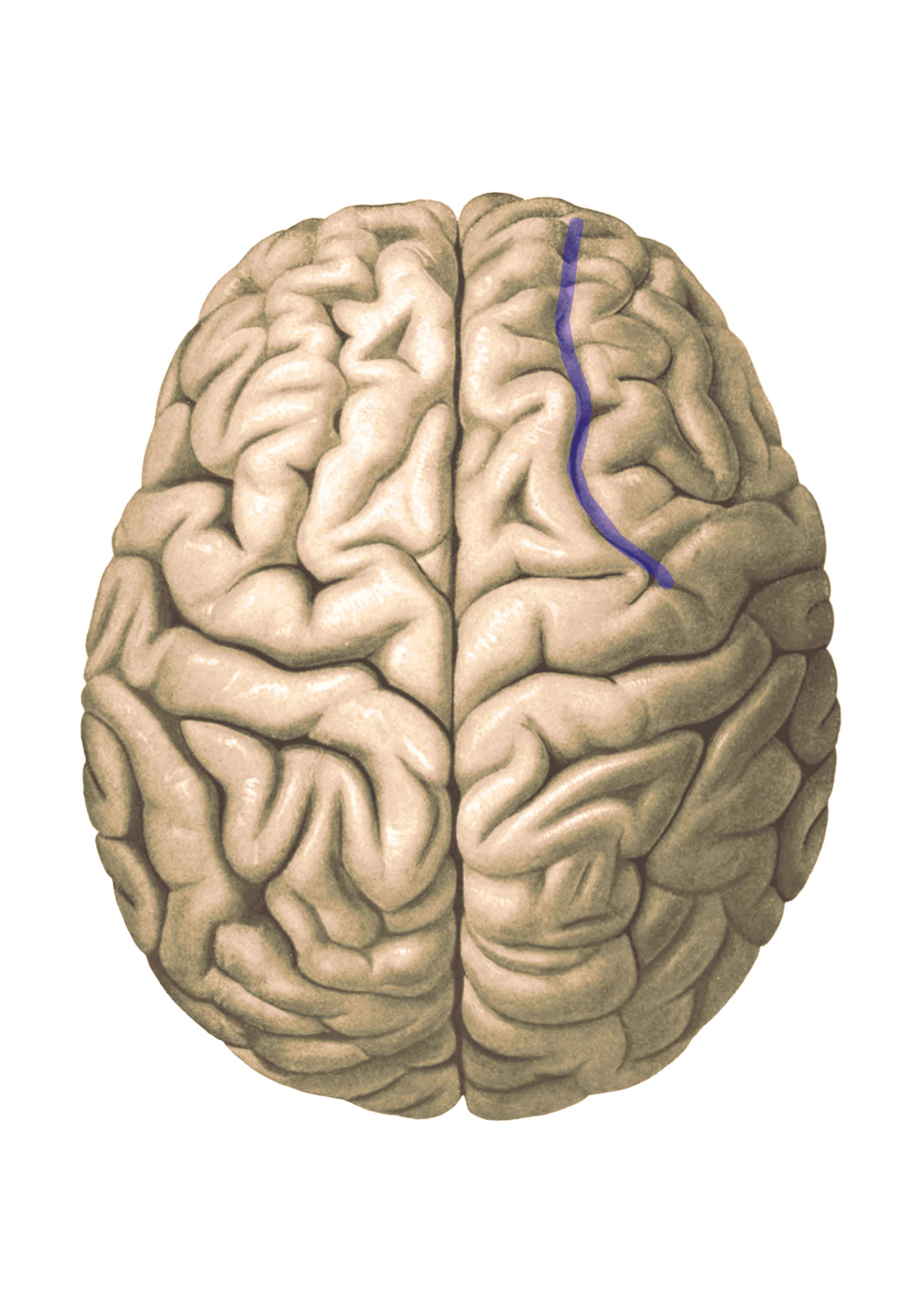 Sulcus frontalis superior