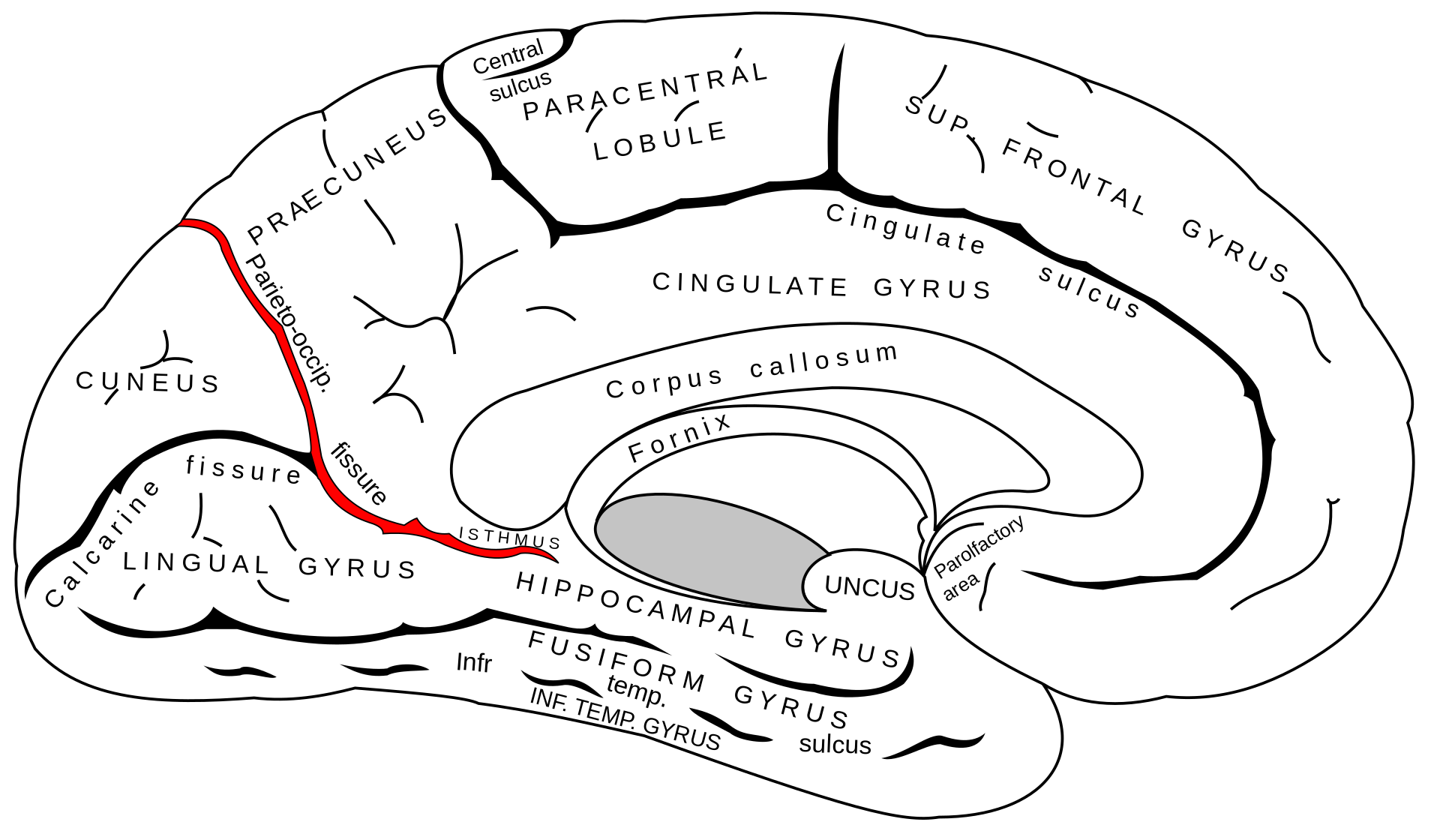 Sulcus parietooccipitalis Abbildung