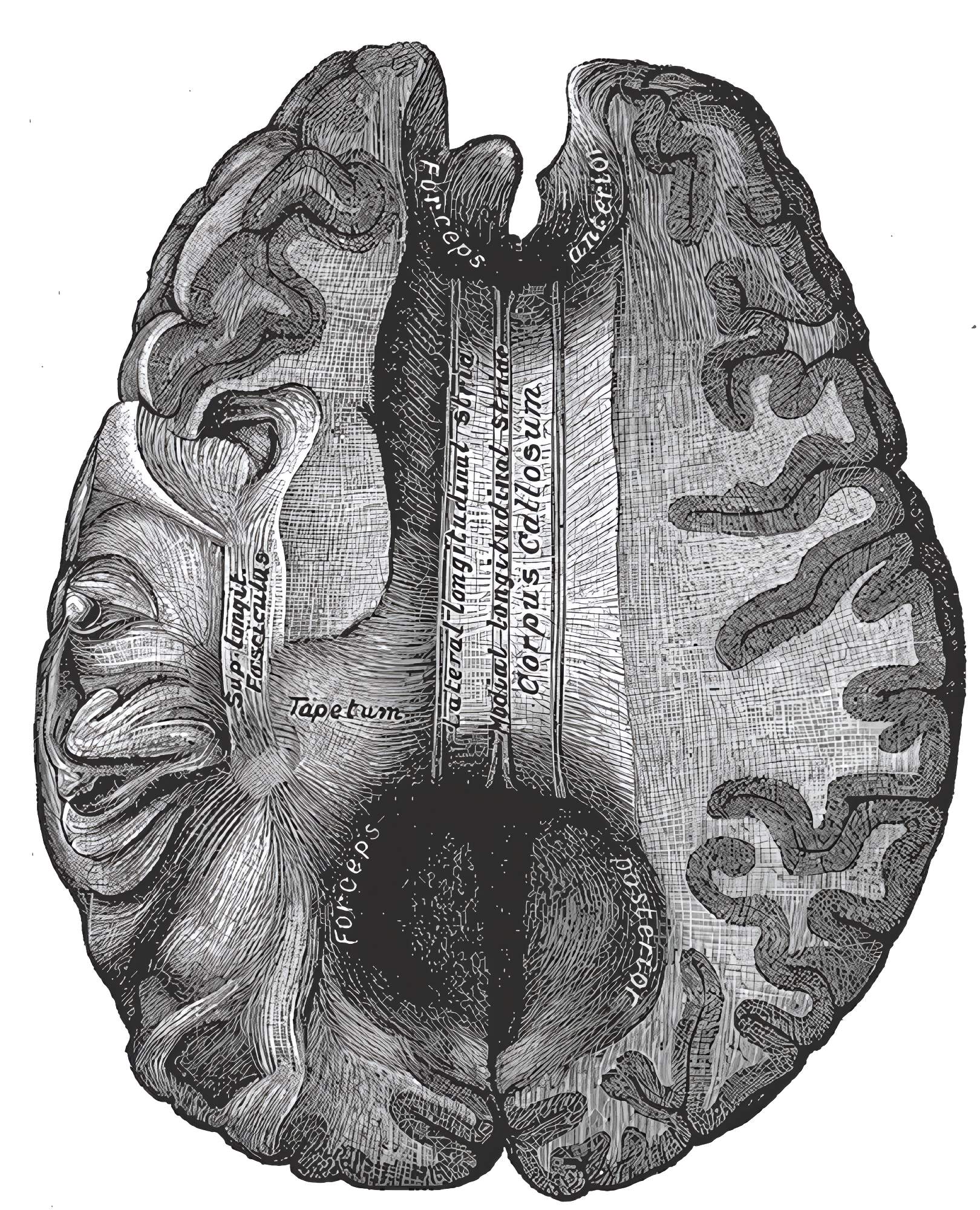 Corpus Callosum Grays Anatomy