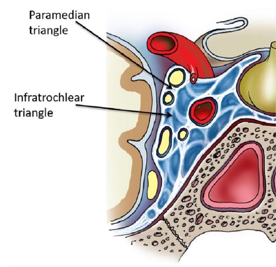 Parkinson Triangle