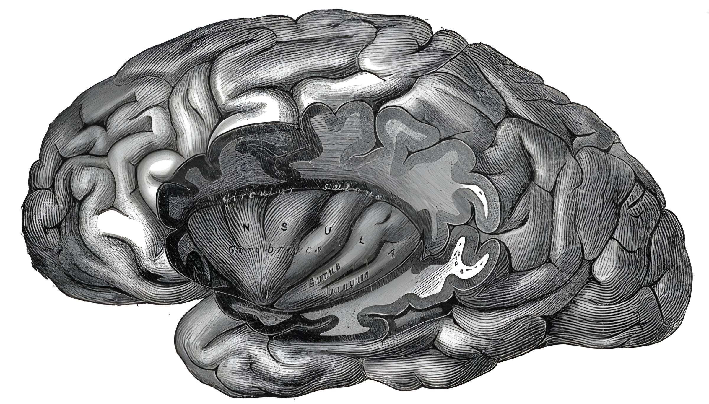 Insula