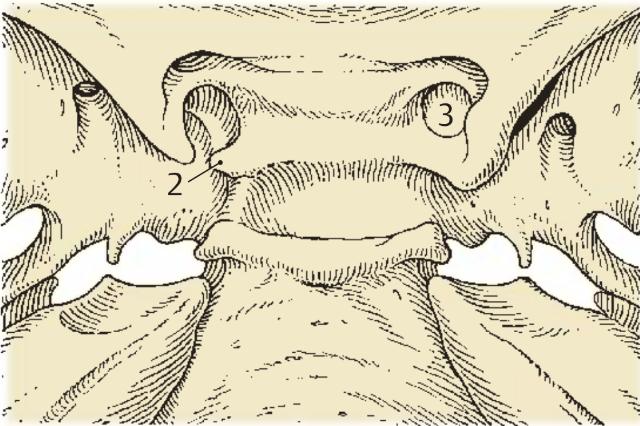 Processus clinoideus medius
