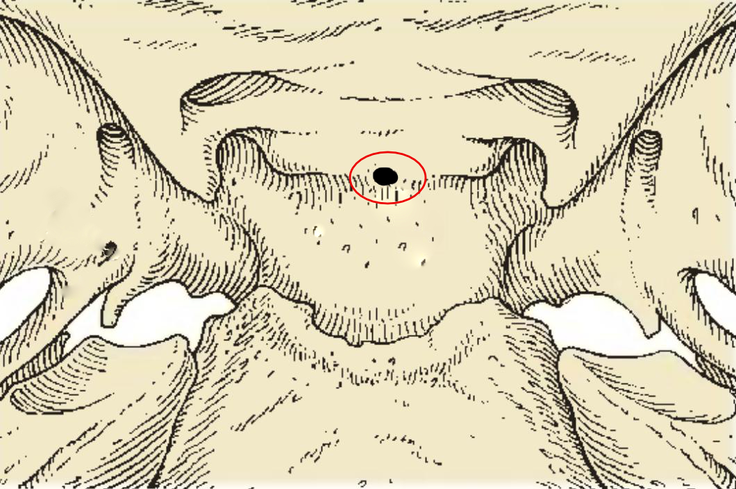 Canalis craniopharyngeus