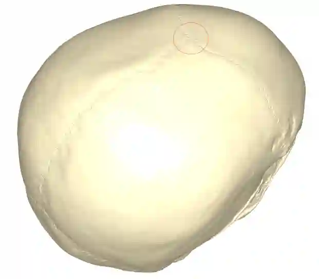 Bregma
