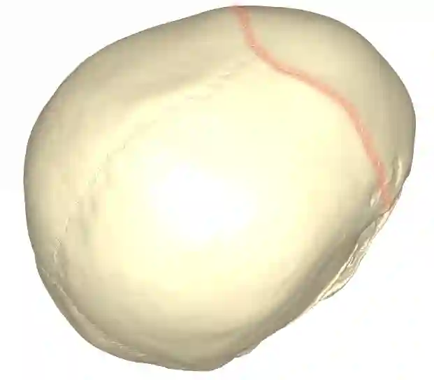 Sutura coronalis