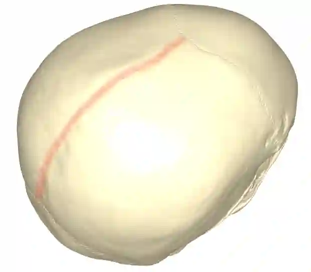 Sutura sagittalis