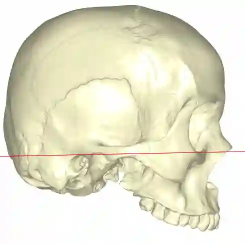Frankfurter horizontale Ebene