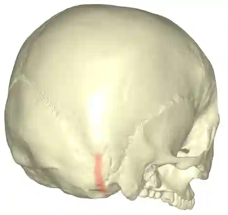 Sutura occipitomastoida