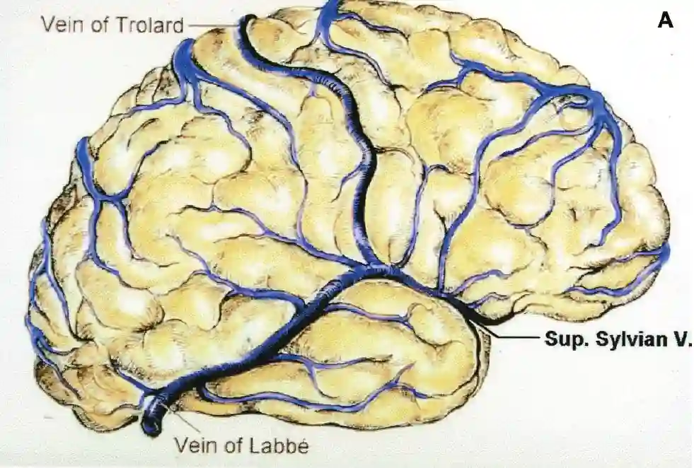 Labbé Vene und Trolard Vene