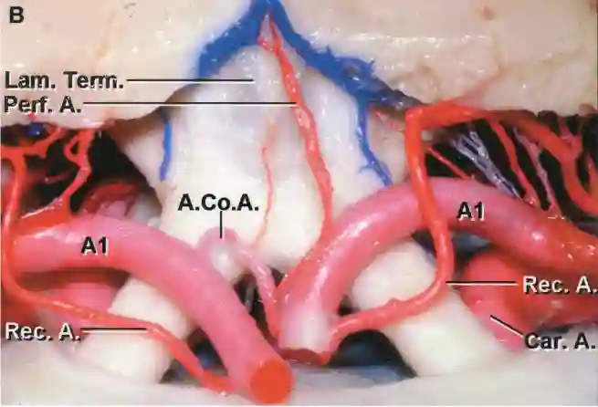 Lamina terminalis