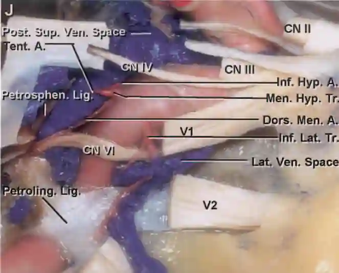 Petrolinguales Ligament