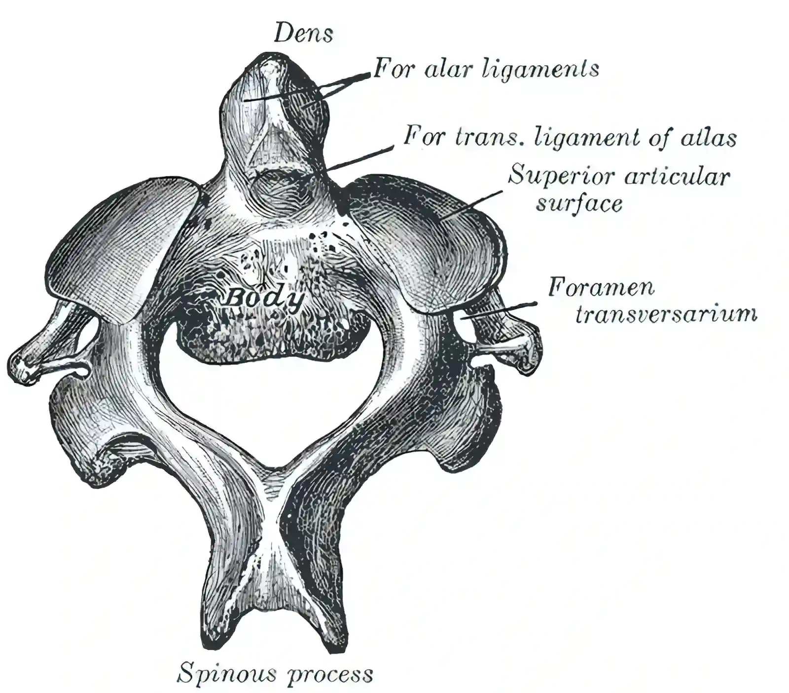 Axis Schematisch