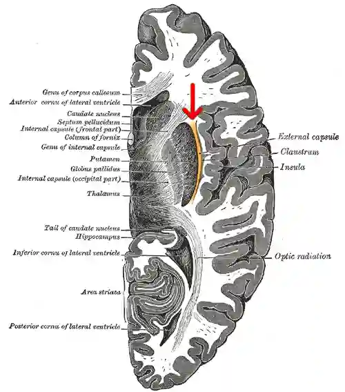 Capsula externa