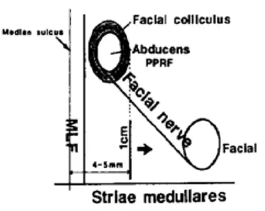 Infrafacial triangle