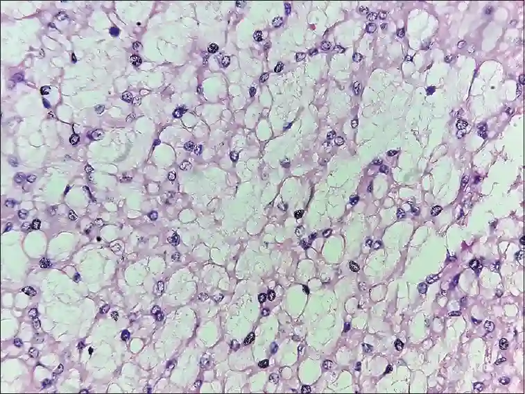 Physaliphorous Cells