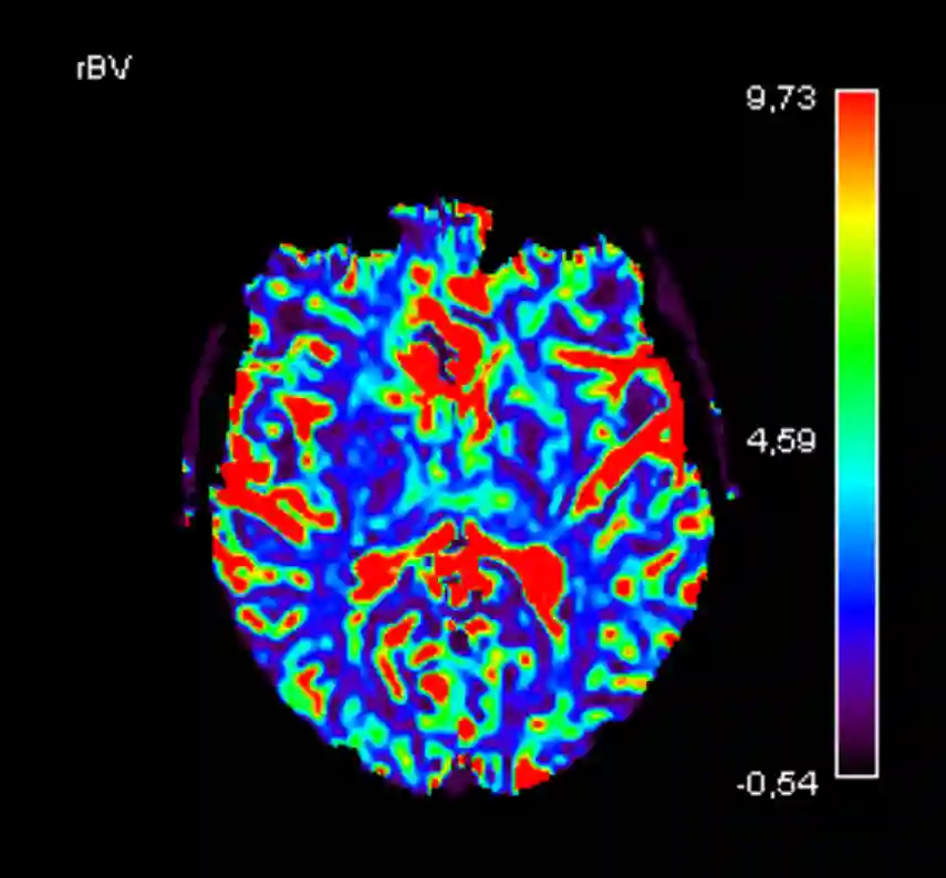 rBV MR Perfusion