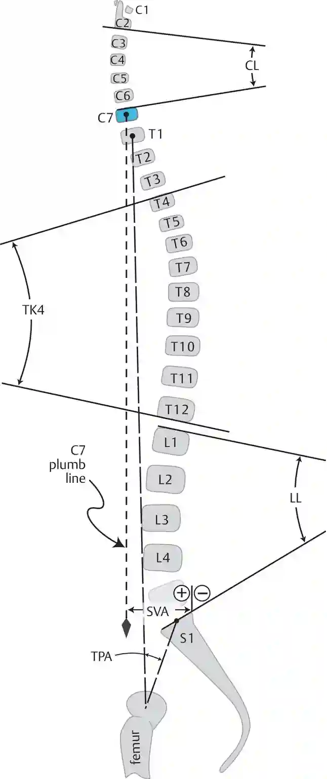 Abmessung Wirbelsäule