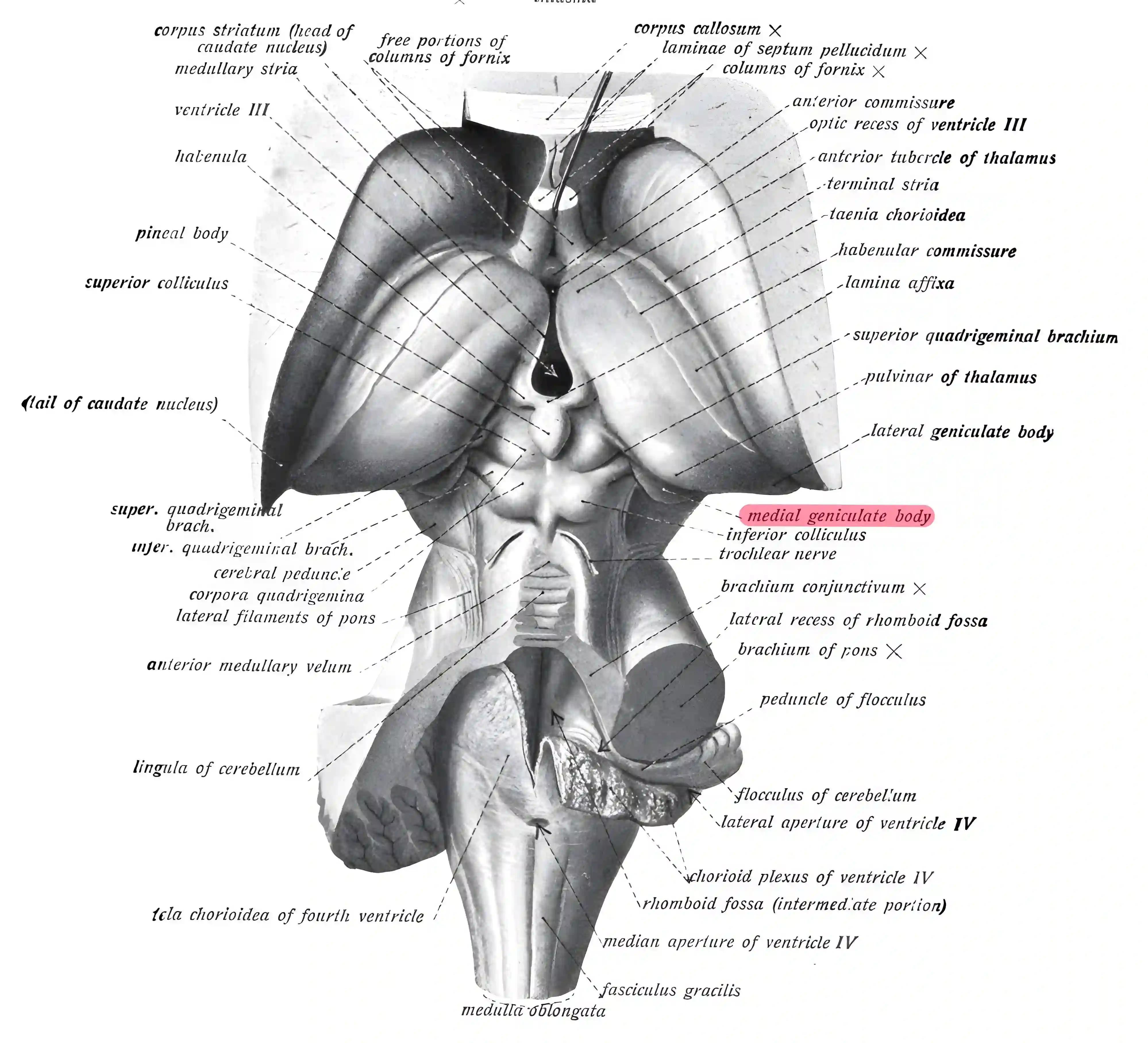 Corpus geniculatum mediale anatomische Zeichnung