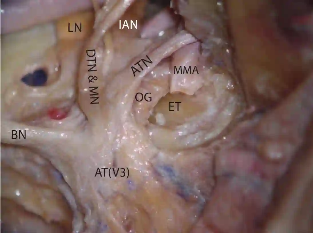 Ganglion oticum