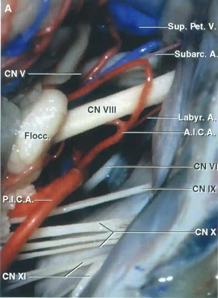 Anatomie Kleinhirnbrückenwinkel
