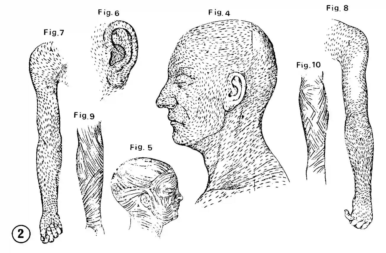 Langer Linien Figure 2
