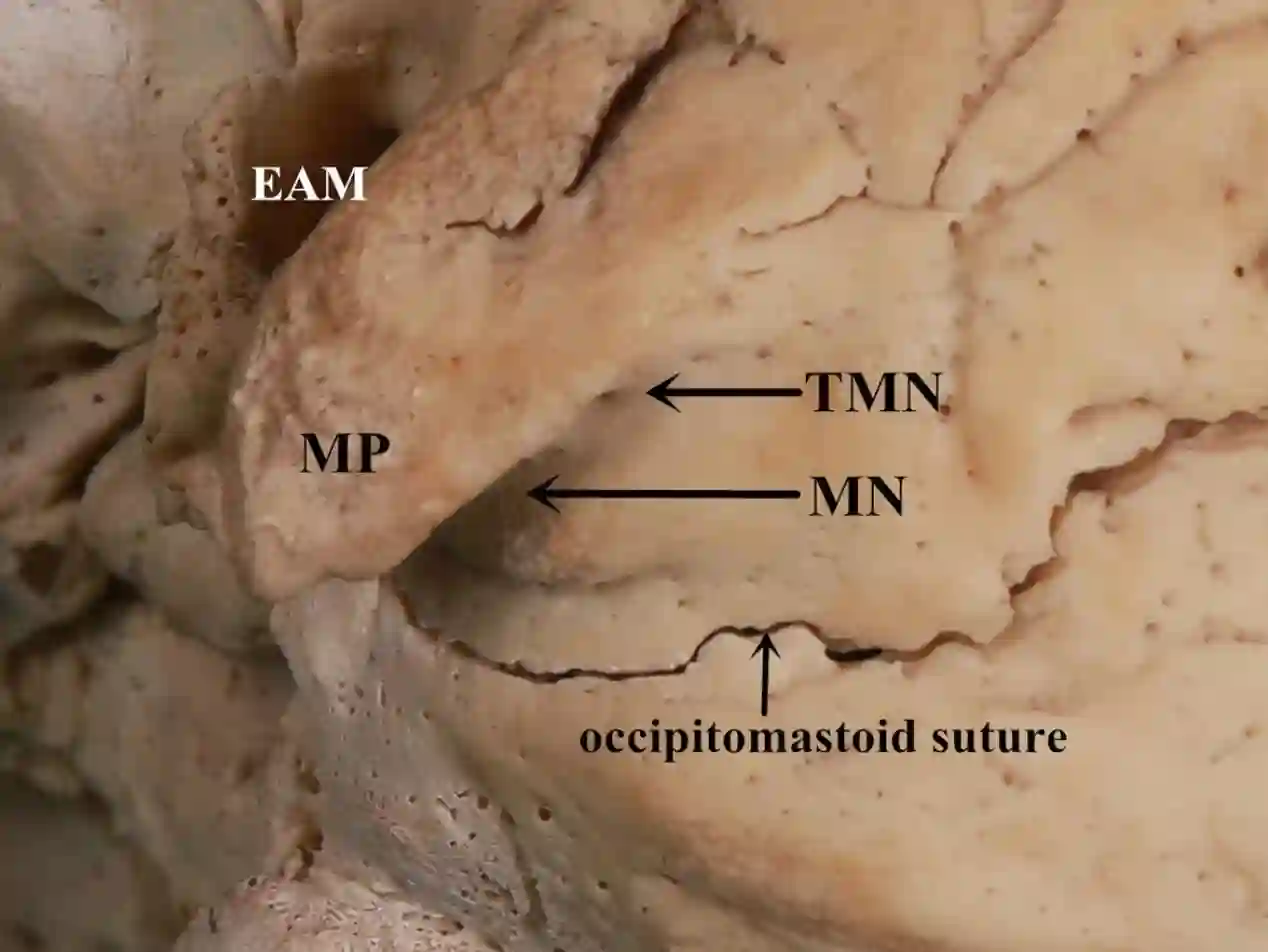 Incisura mastoidea