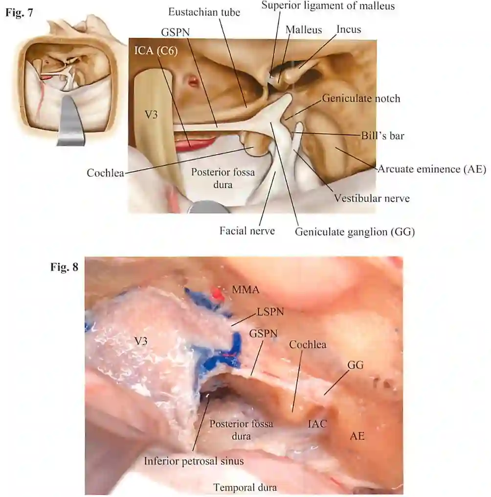 Anatomie mittlere Schädelgrube