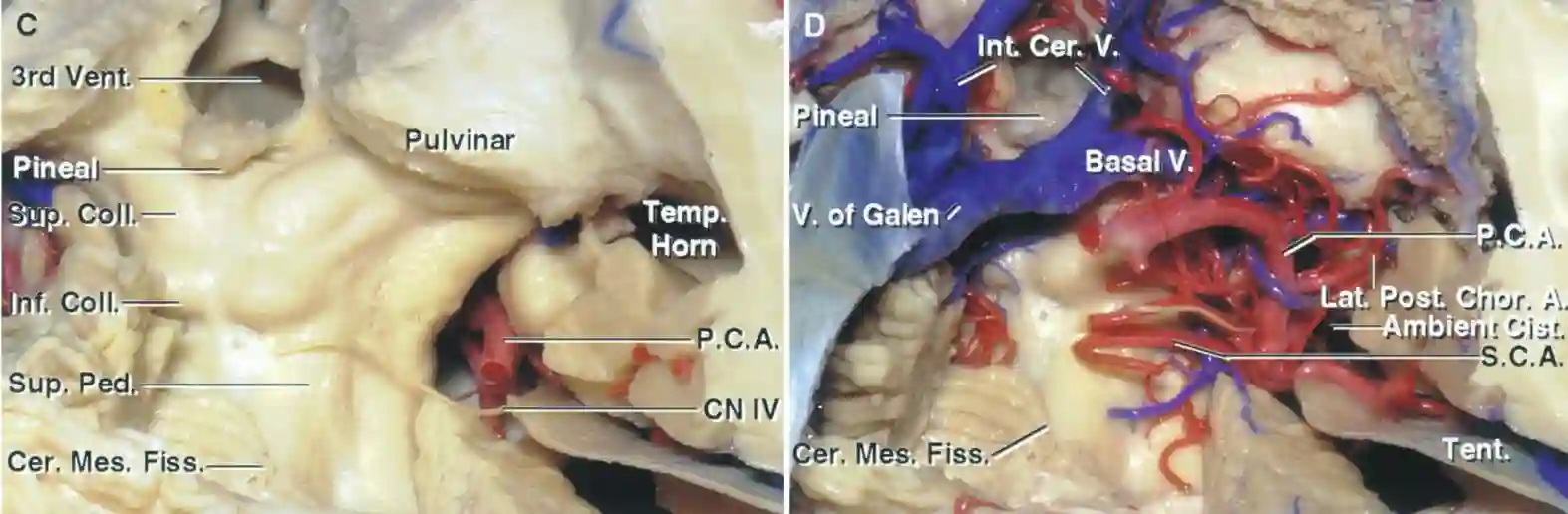 Tectum von posterior Rhoton