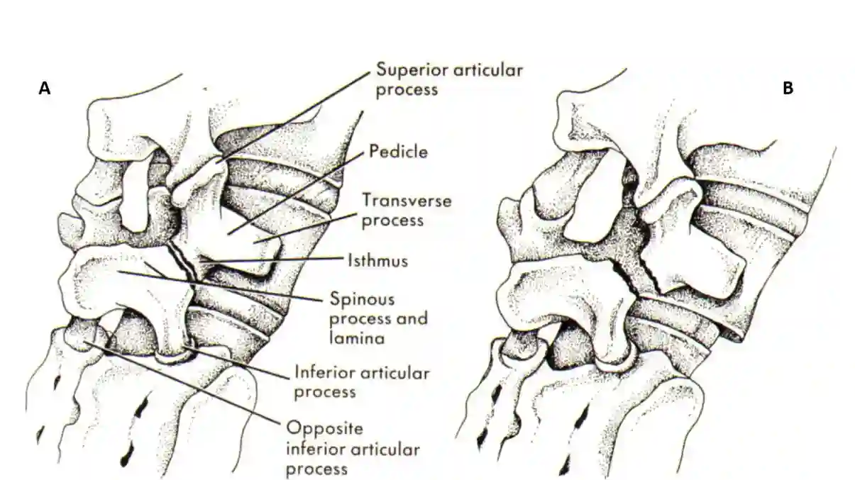Scottie Dogn Sign Schematisch