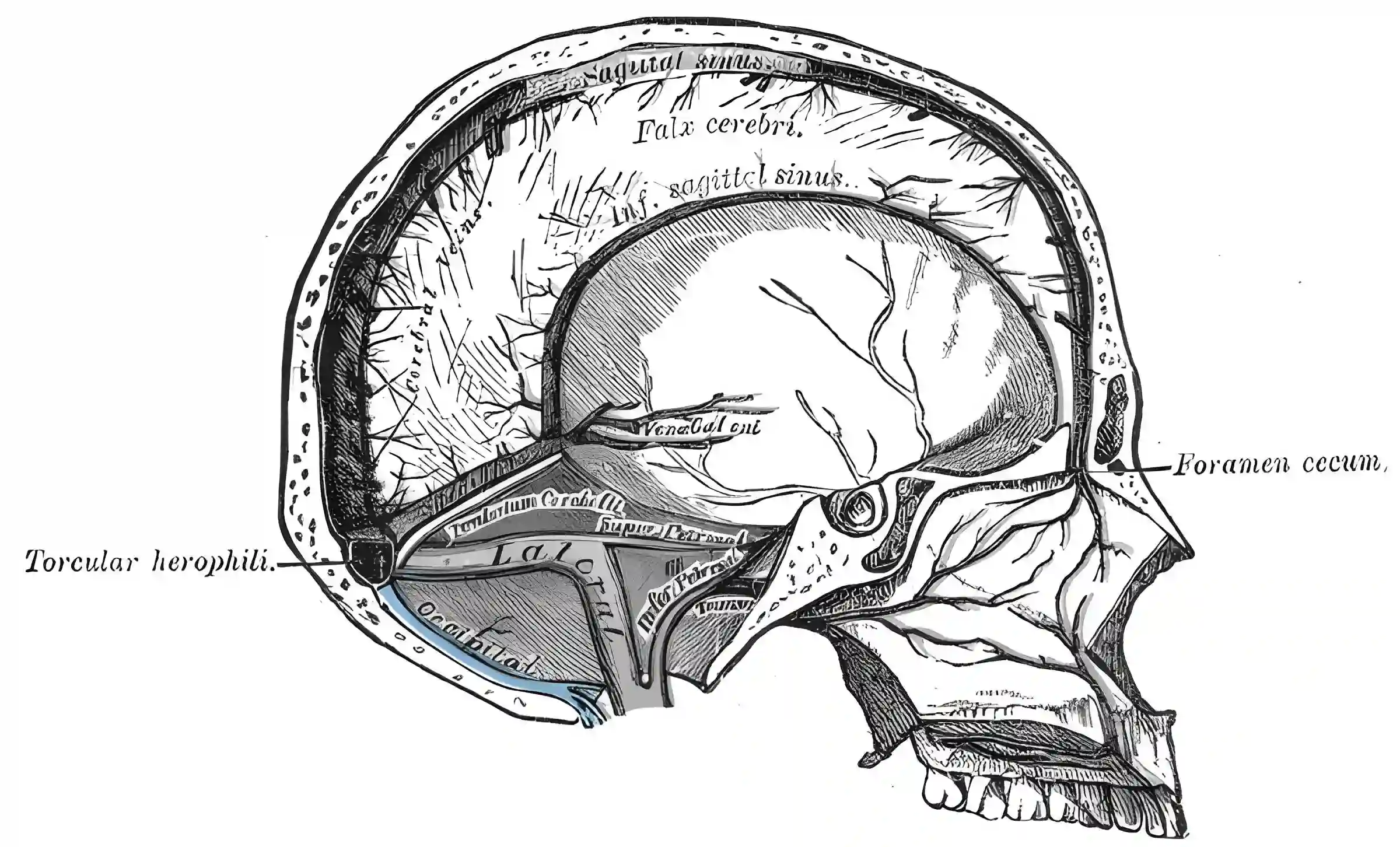Sinus occipitalis anatomische Zeichnung