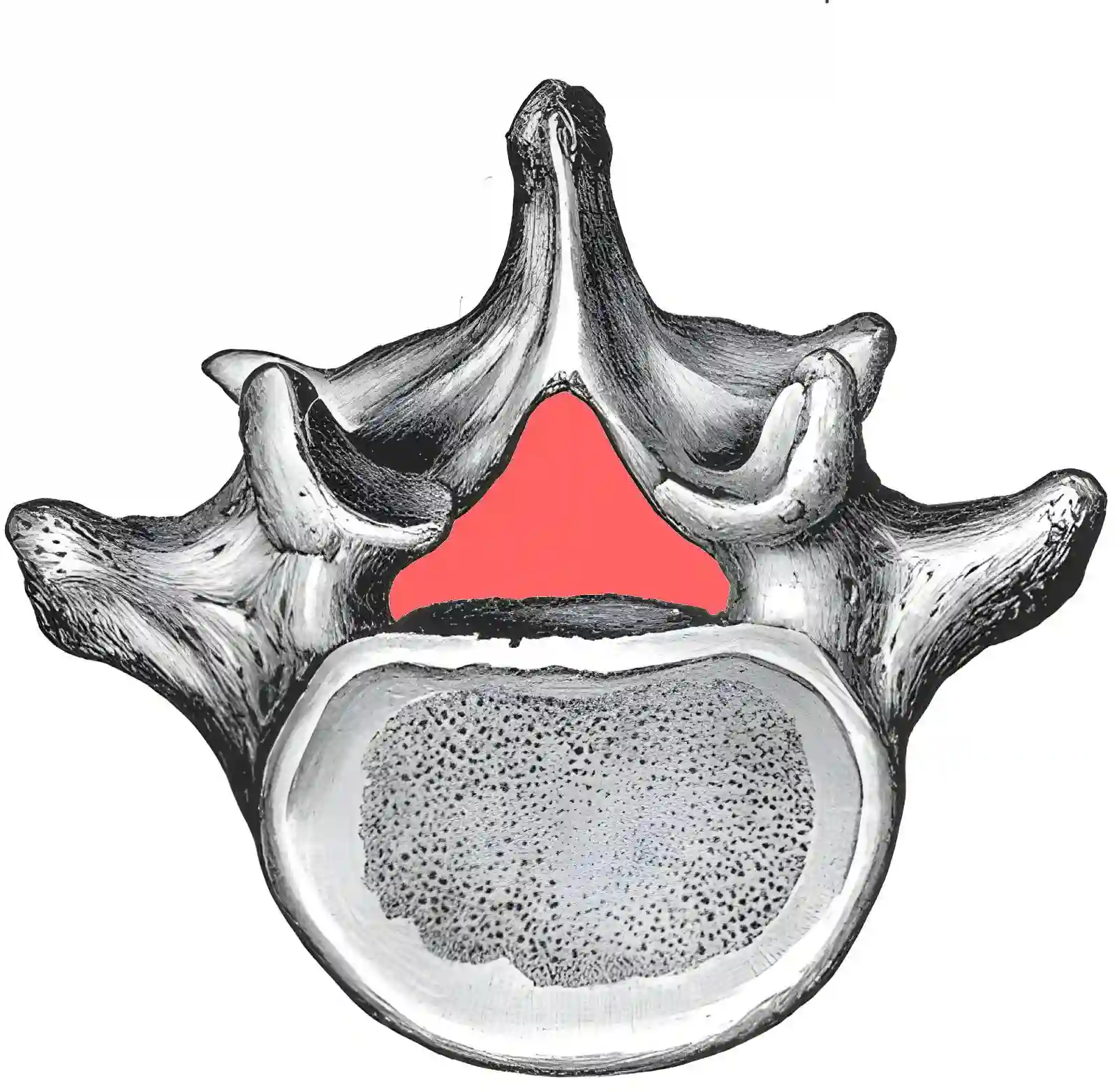 Spinalkanal schematische Darstellung