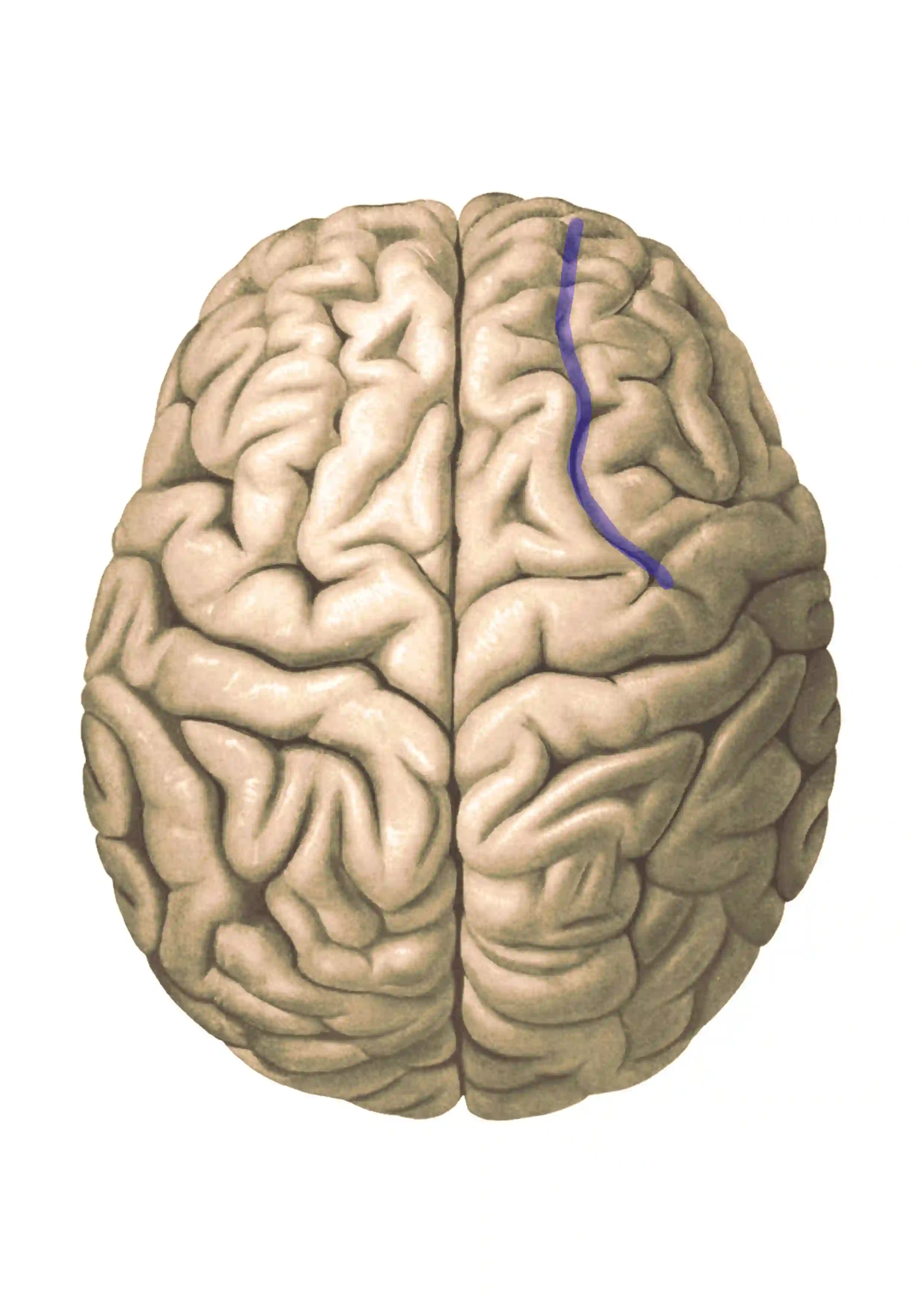 Sulcus frontalis superior
