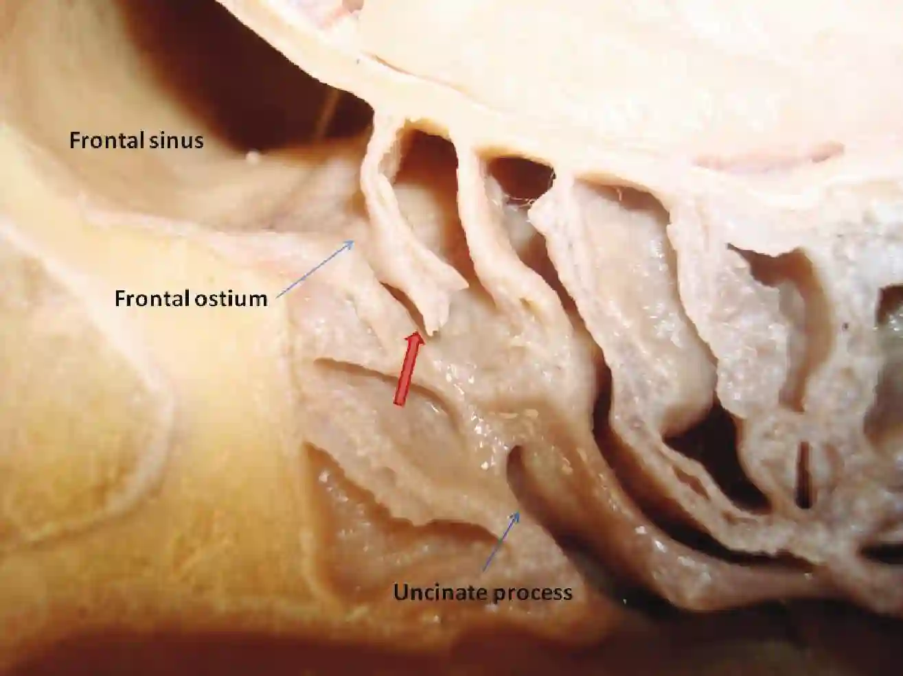 Ductus frontonasalis anatomisches Präparat