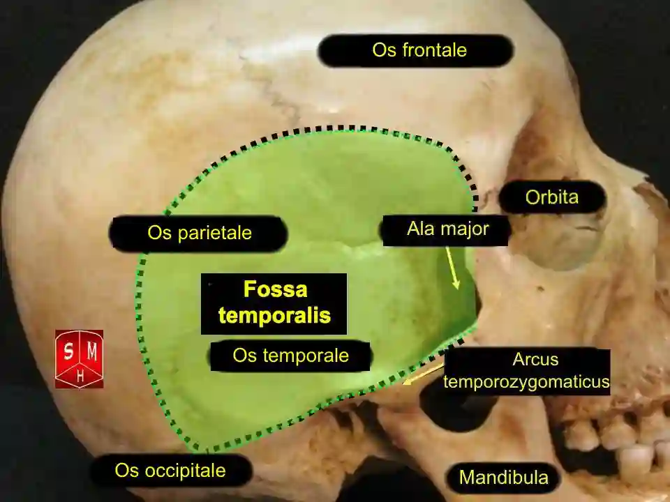 Fossa temporalis