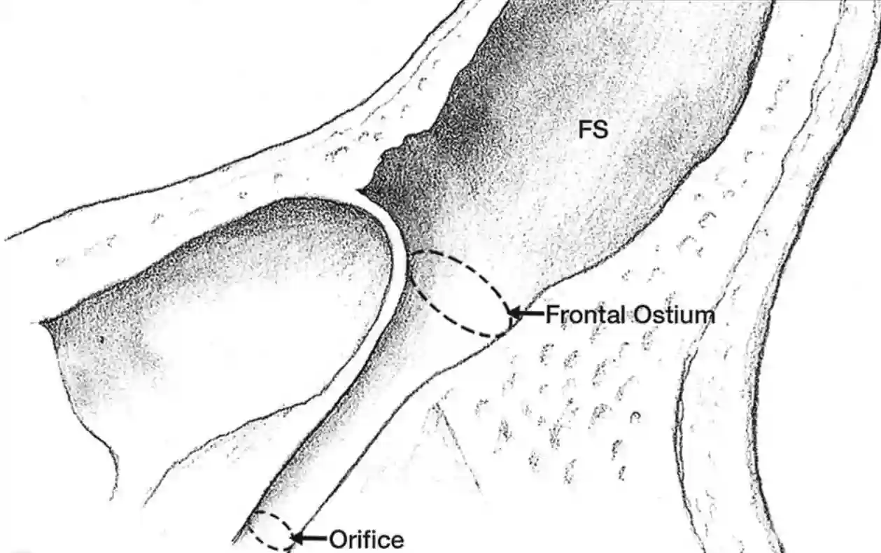 Ductus nasofrontalis schematisch