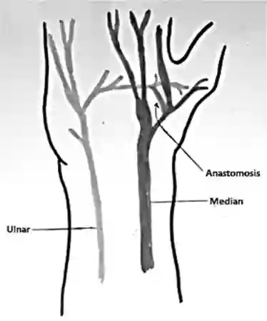 Riche-Cannieu Anastomose