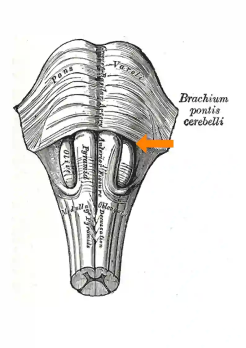Sulcus bulbopontinus