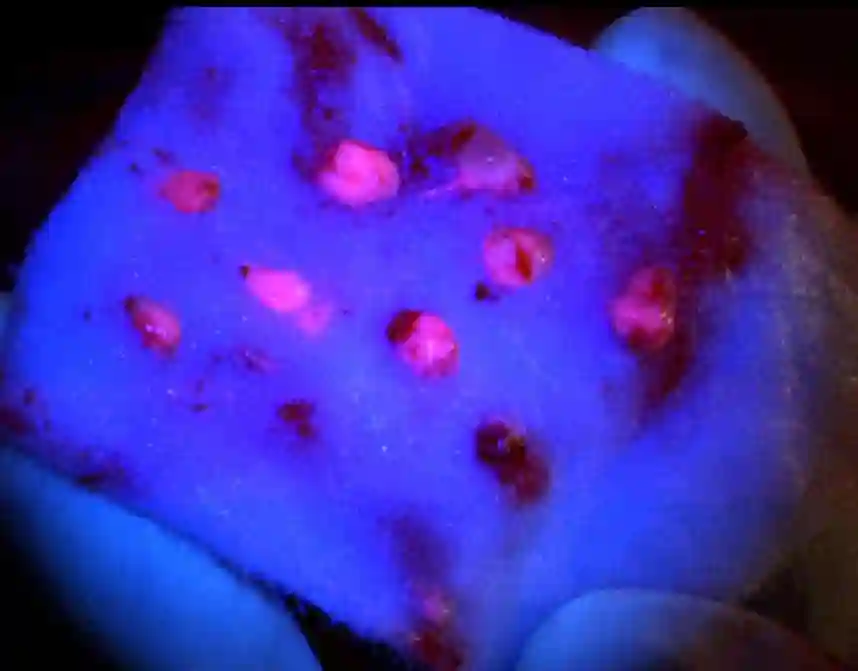 5-ALA positives Gewebe