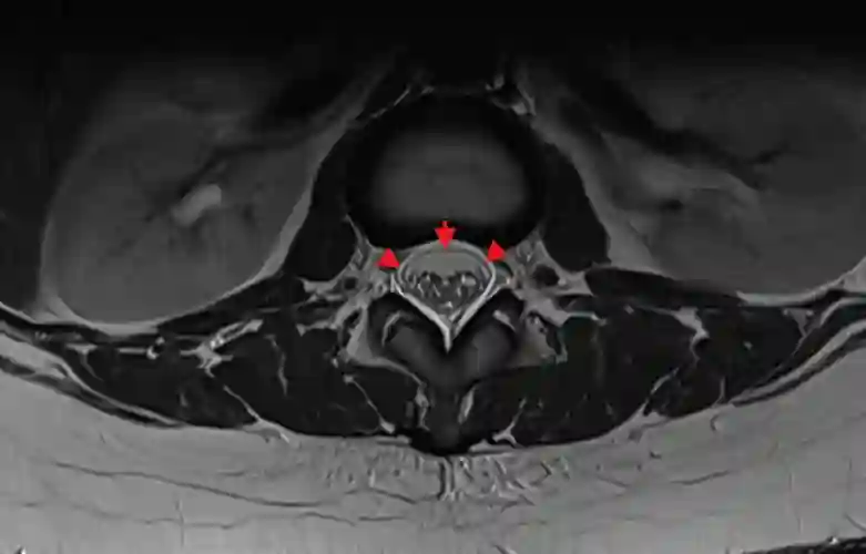 Duradoppelkontur axiales MRi